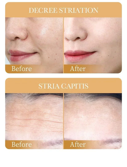 SADOER Collagen Face Mask 10pcs