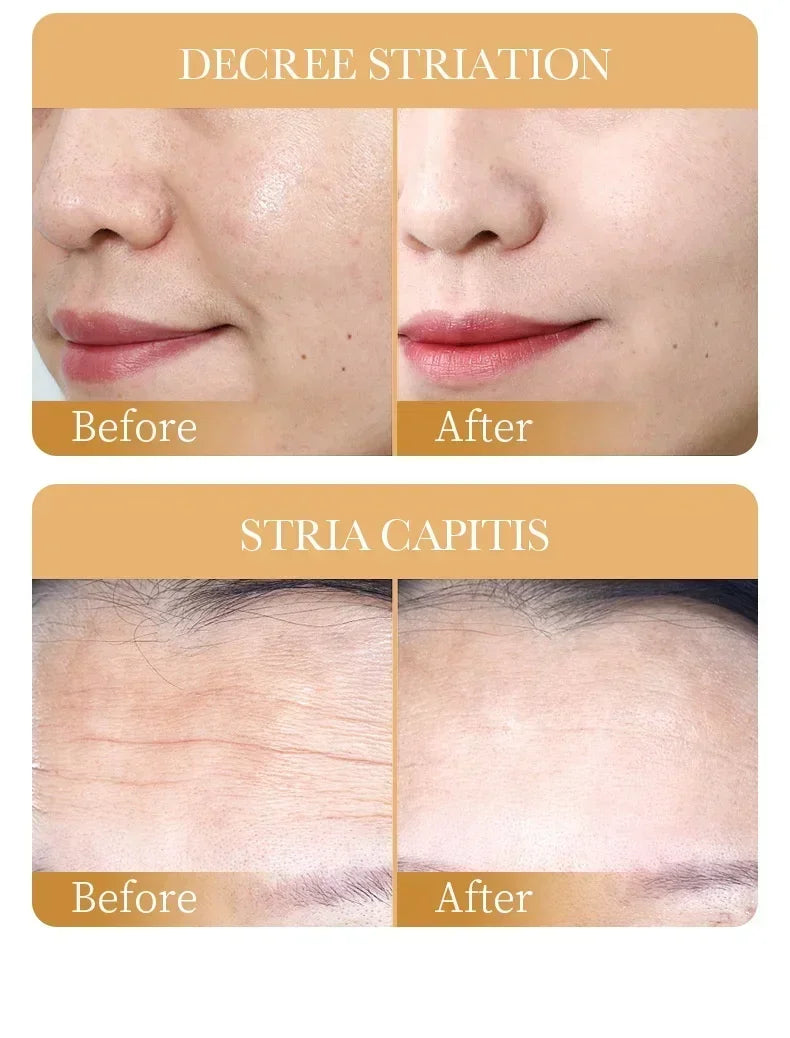 SADOER Collagen Face Mask 10pcs