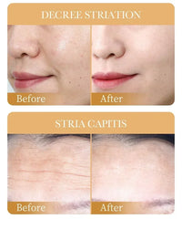 SADOER Collagen Face Mask 10pcs